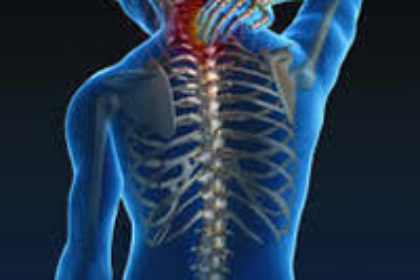 musculoskeletal-disorders-250×250