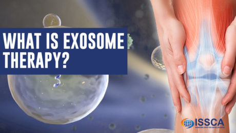 what is exosome therapy
