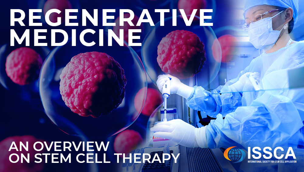Regenerative Medicine An Overview On Stem Cell Therapy Issca™ International Society For