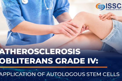 ISSCA-atherosclerosis